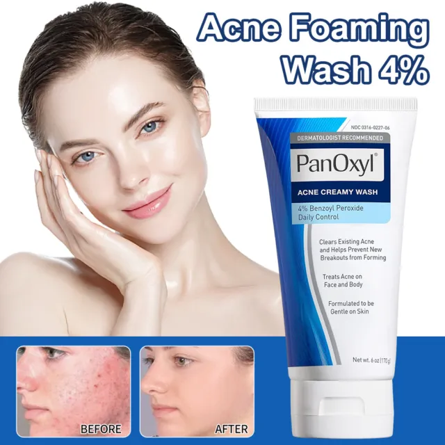 PanOxyl® Acne Creamy Wash Benzoyl Peroxide 4% - Image 4